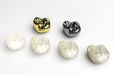 How Important is Your Choice of Dental Crown Material?